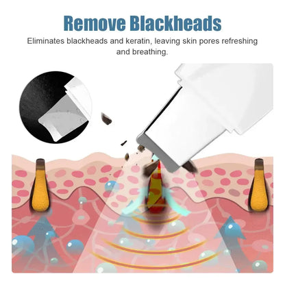 Deep Vibrating Skin Scrubber Facial Cleaner